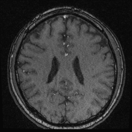 Click on the Serie image to view the images of VILLANUEVA, WILLIAM A.